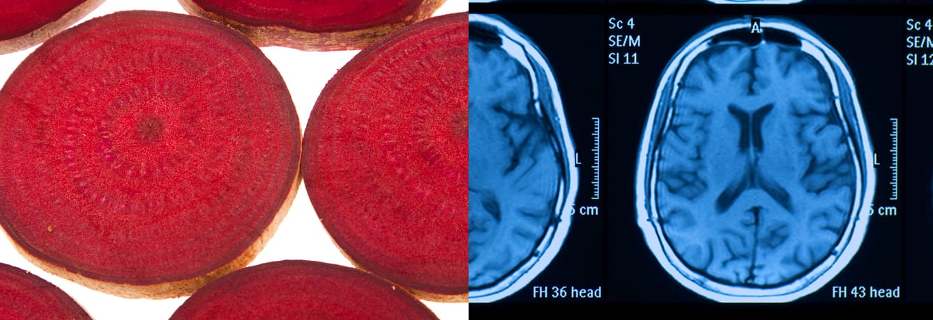 Beets-and-Brain-Health